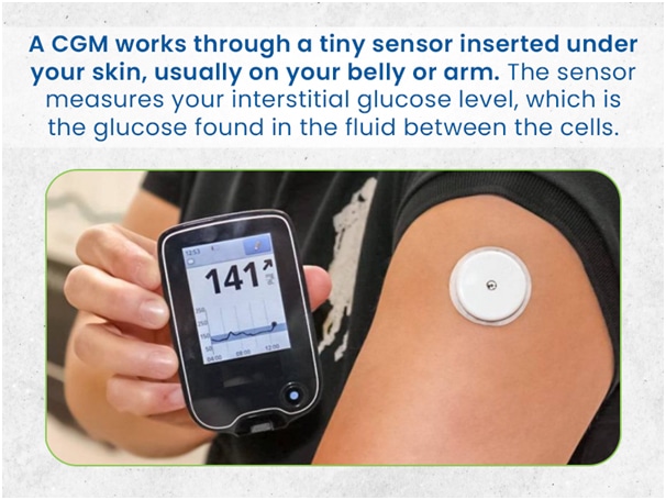 How Do Continuous Glucose Monitoring (CGM) Devices Work?
